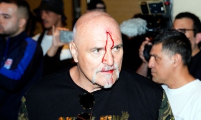 Tyson Fury&#039;s dad headbutts member of Oleksandr Usyk&#039;s entourage at media day fracas