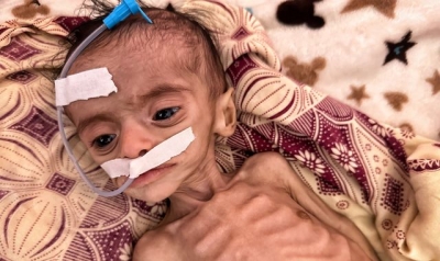 Babies are starving as Yemen teeters on brink of collapse - while Houthis use Gaza crisis to earn &#039;hero&#039; status